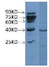 NdhH | NAD(P)H-quinone oxidoreductase subunit H (chloroplastic) in the group Antibodies for Plant/Algal / Photosynthesis / Electron transfer at Agrisera AB (Antibodies for research) (AS13 2712)
